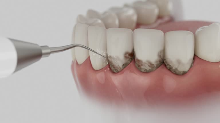 Reliable Dental Implants contractor in Villas, FL by Smile Center Dentistry